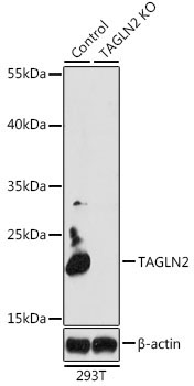 TAGLN2 Rabbit Polyclonal Antibody [KO Validated]