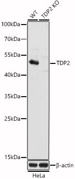 TDP2 Rabbit Polyclonal Antibody [KO Validated]