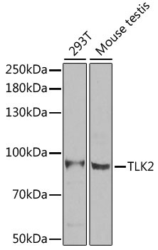 TLK2 Rabbit Polyclonal Antibody [KO Validated]