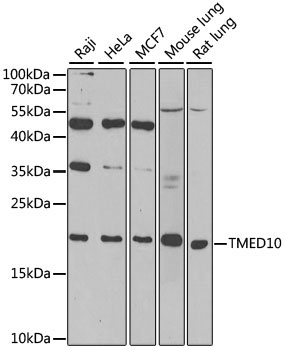 TMED10 Rabbit Polyclonal Antibody [KO Validated]