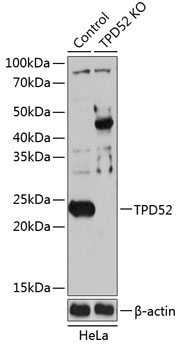 TPD52 Rabbit Polyclonal Antibody [KO Validated]