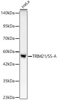 TRIM21/SS-A Rabbit Monoclonal Antibody [KO Validated]