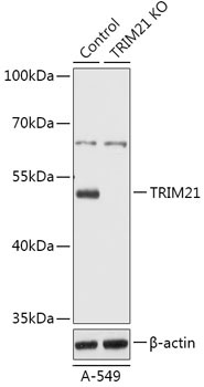 TRIM21/SS-A Rabbit Polyclonal Antibody [KO Validated]