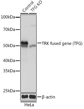 TRK fused gene (TFG) Rabbit Polyclonal Antibody [KO Validated]