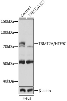 TRMT2A/HTF9C Rabbit Polyclonal Antibody [KO Validated]