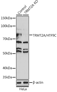 TRMT2A/HTF9C Rabbit Polyclonal Antibody [KO Validated]