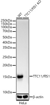 TTC11/FIS1 Rabbit Monoclonal Antibody [KO Validated]