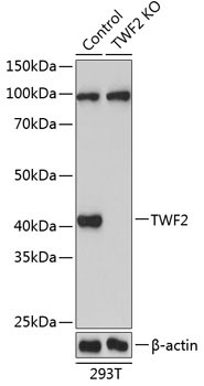 TWF2 Rabbit Polyclonal Antibody [KO Validated]