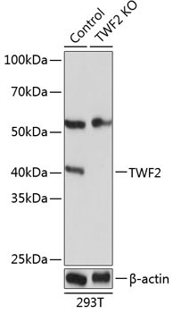 TWF2 Rabbit Polyclonal Antibody [KO Validated]