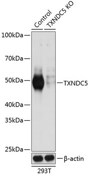 TXNDC5 Rabbit Polyclonal Antibody [KO Validated]