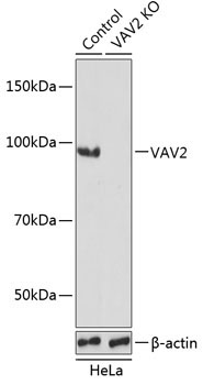 VAV2 Rabbit Polyclonal Antibody [KO Validated]