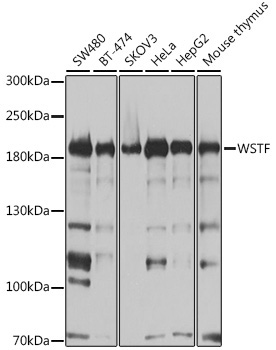 WSTF Rabbit Polyclonal Antibody [KO Validated]