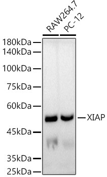 XIAP Rabbit Monoclonal Antibody [KO Validated]