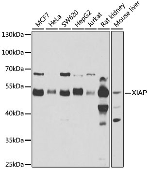 XIAP Rabbit Polyclonal Antibody [KO Validated]