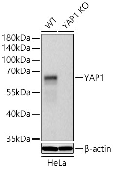 YAP1 Rabbit Monoclonal Antibody [KO Validated]