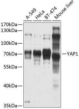 YAP1 Rabbit Polyclonal Antibody [KO Validated]