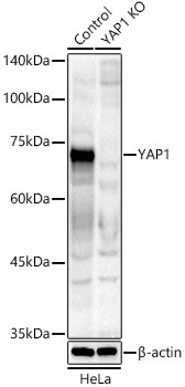 YAP1 Rabbit Polyclonal Antibody [KO Validated]