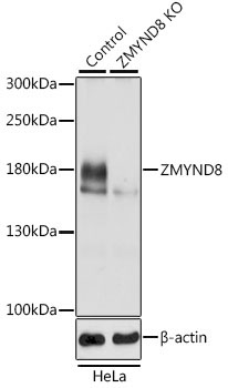 ZMYND8 Rabbit Polyclonal Antibody [KO Validated]