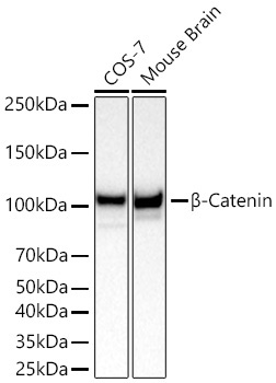 Beta-Catenin Rabbit Monoclonal Antibody [KO Validated]