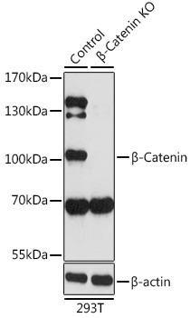 Beta-Catenin Rabbit Polyclonal Antibody [KO Validated]