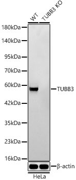 BetaIII-Tubulin Rabbit Monoclonal Antibody [KO Validated]