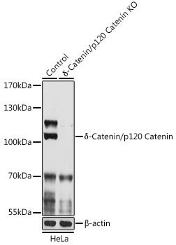 Delta-Catenin/p120 Catenin Rabbit Polyclonal Antibody [KO Validated]