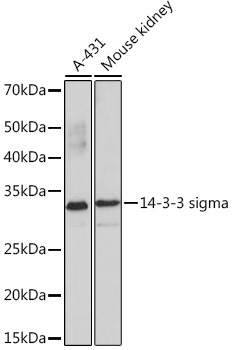 14-3-3 sigma Rabbit Monoclonal Antibody