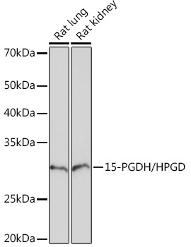 15-PGDH/HPGD Rabbit Monoclonal Antibody