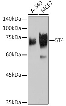 5T4 Rabbit Monoclonal Antibody