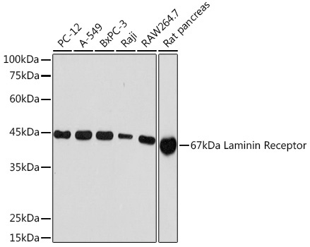 67kDa Laminin Receptor Rabbit Monoclonal Antibody