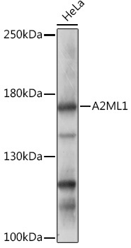 A2ML1 Rabbit Polyclonal Antibody