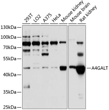 A4GALT Rabbit Polyclonal Antibody
