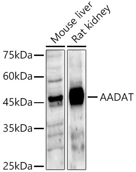 AADAT Rabbit Polyclonal Antibody