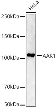AAK1 Rabbit Polyclonal Antibody