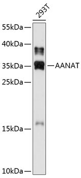 AANAT Rabbit Polyclonal Antibody