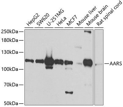 AARS Rabbit Polyclonal Antibody