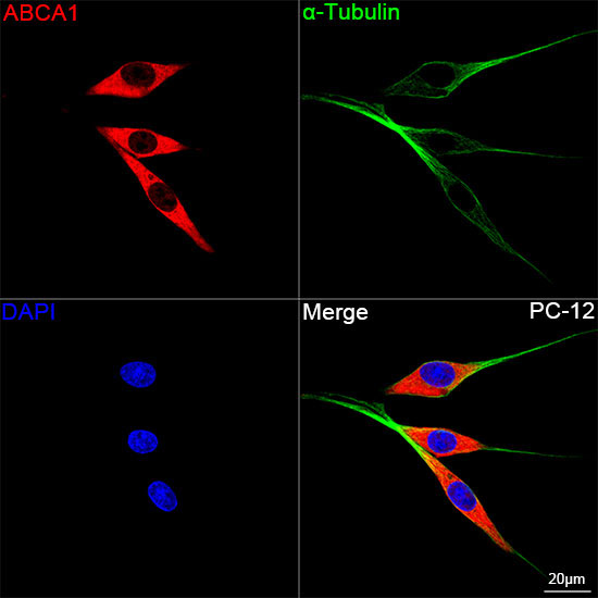 ABCA1 Rabbit Monoclonal Antibody