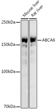 ABCA6 Rabbit Polyclonal Antibody
