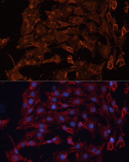 ABCB11 Rabbit Polyclonal Antibody