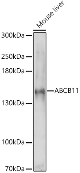 ABCB11 Rabbit Polyclonal Antibody