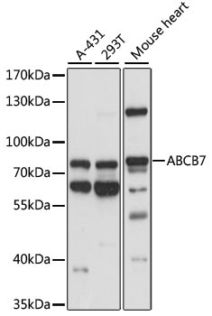 ABCB7 Rabbit Polyclonal Antibody