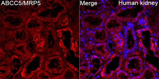ABCC5/MRP5 Rabbit Polyclonal Antibody