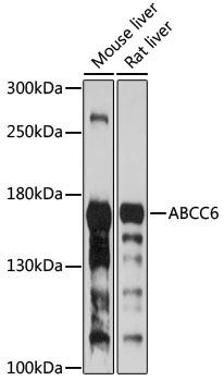 ABCC6 Rabbit Polyclonal Antibody