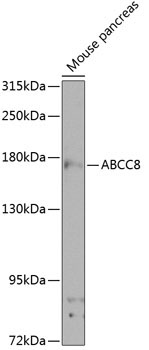 ABCC8 Rabbit Polyclonal Antibody