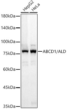 ABCD1 / ALD Rabbit Monoclonal Antibody