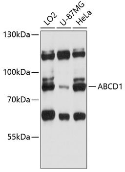 ABCD1 Rabbit Polyclonal Antibody