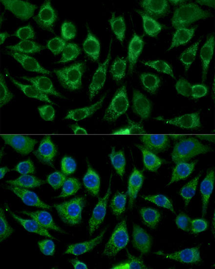 ABCD2 Rabbit Polyclonal Antibody