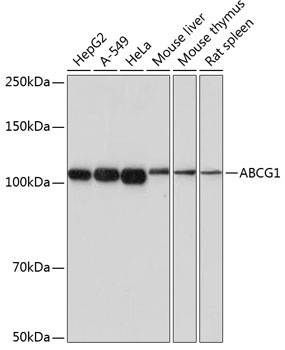 ABCG1 Rabbit Monoclonal Antibody