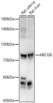 ABCG8 Rabbit Polyclonal Antibody
