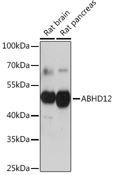 ABHD12 Rabbit Polyclonal Antibody